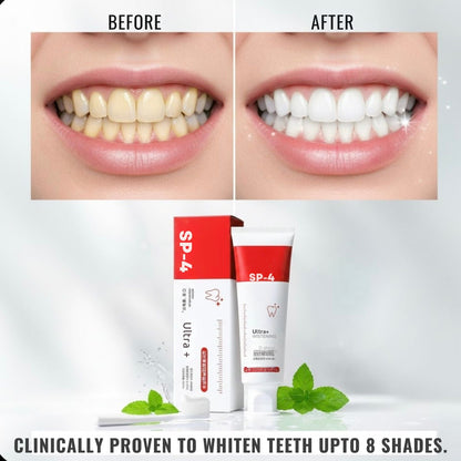Before and after comparison of teeth whitening with SP-4 toothpaste and packaging.